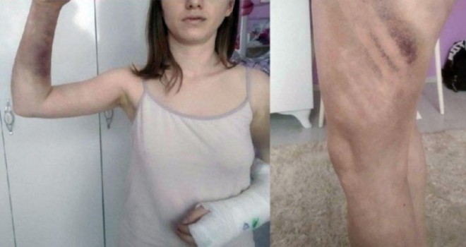 Karşıyaka'da kız arkadaşını beyzbol sopasıyla dövenin 25 yıla kadar hapsi istendi