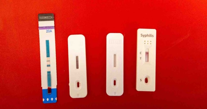 İzmir Büyükşehir’den kimliksiz ve ücretsiz test hizmeti