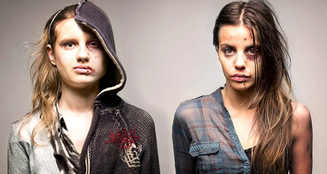 Çocuğunuzun uyuşturucu kullandığını yüzünden anlayabilirsiniz!