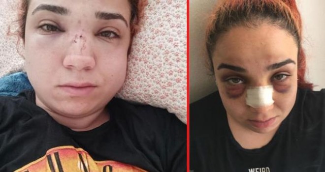 Karşıyaka'da genç kadın patronundan dayak yedi