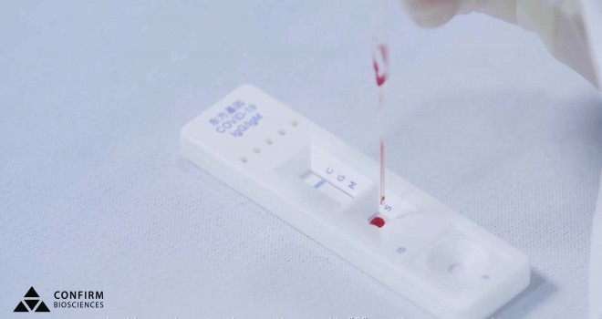 Türk gençler ABD'de Korona virüsü testi kitleri üretti