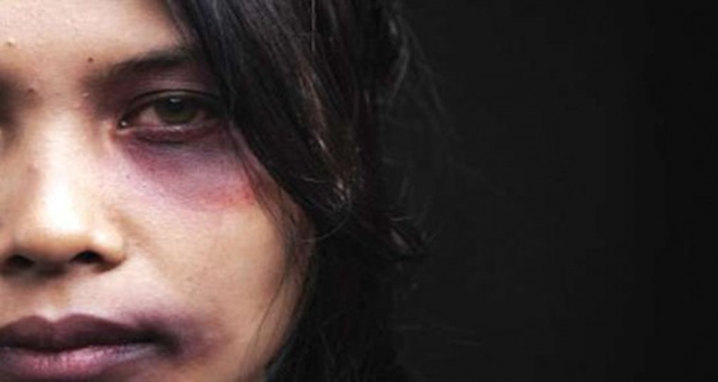 Erkek şiddetinden yüzünü değiştirerek kurtulacak