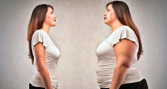 ''Obezite tedavisinde hedefler gerçekçi olmalı''