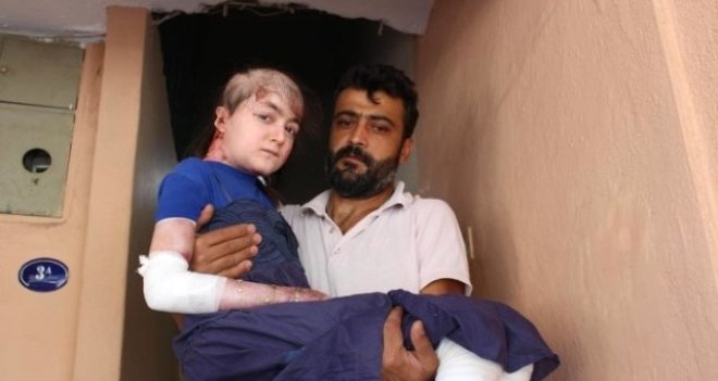 Vücudu eriyen Gamze'nin tek bir isteği var