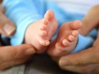 2500 kız çocuktan biri ''Turner''Sendromu ile doğuyor