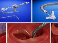 Bu mandallar hayat kurtarıyor