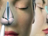 Burun Estetiği ile Şekil ve İşlev Düzeltme