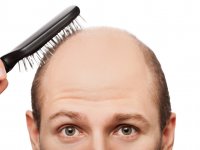 Erkeklerde saç dökülmesinin sebebi testosteron