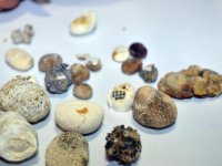 Fuarda böbrek taşı sergisi