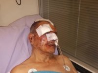 Karşıyaka'da apartman aidatını isteyen yönetici hastanelik oldu