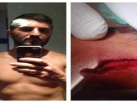 Karşıyakalı Rıdvan'a 15 dikiş atıldı