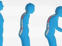 Menopoz sonrası kemik taramasını ihmal etmeyin