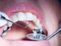 Sağlıksız dişlere dikkat...