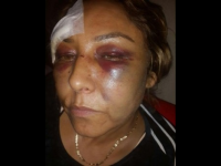 Saldırganın serbest bırakılmasına tepki...