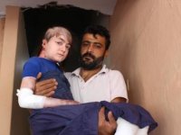 Vücudu eriyen Gamze'nin tek bir isteği var