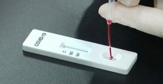 İzmir'de koronavirüsten vefat eden kişi sayısı açıklandı