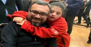 Baran: Down sendromu bir eksiklik değil