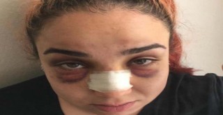 Çalışanının burnunu kıran patrona 4,5 yıla kadar hapis istemi