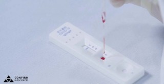 Türk gençler ABD'de Korona virüsü testi kitleri üretti